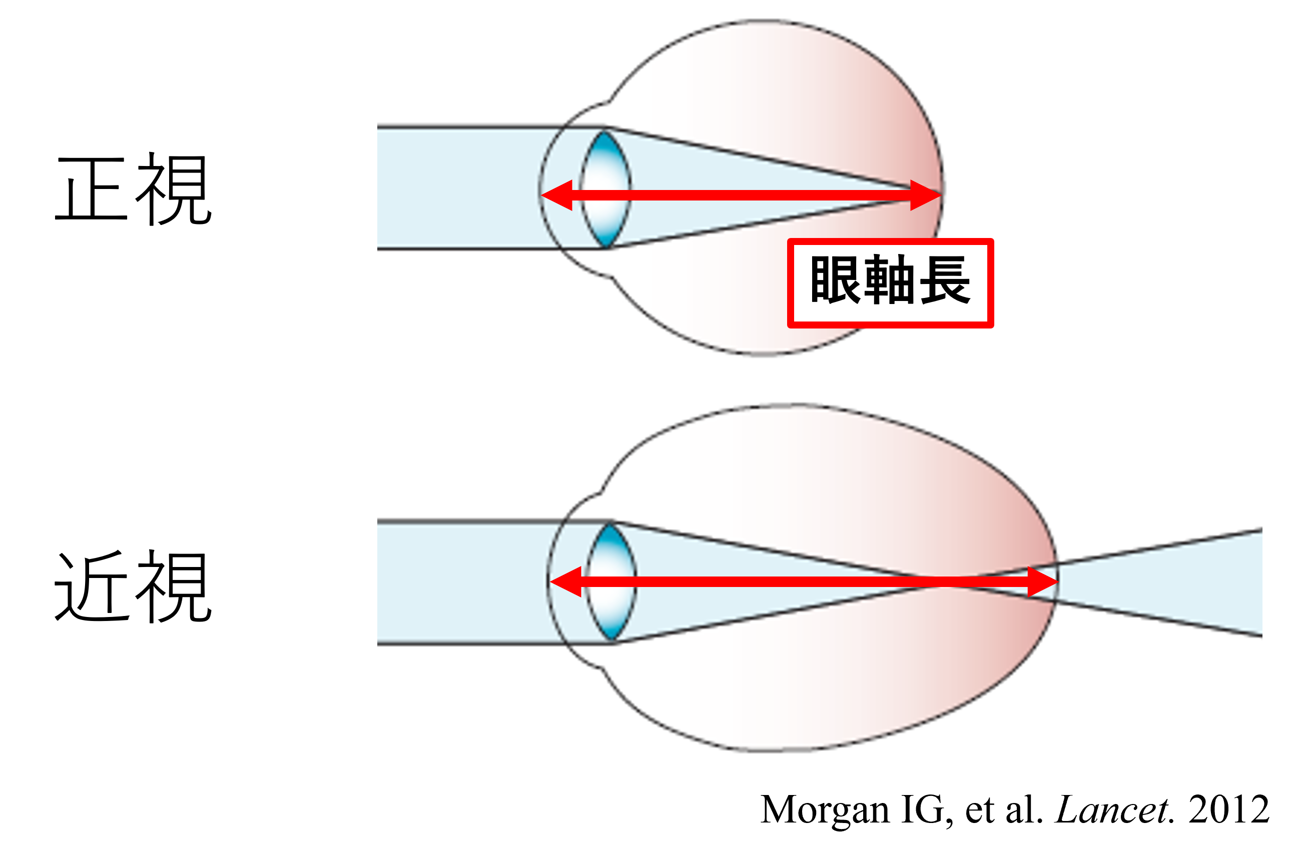 子どもの目を守るためには